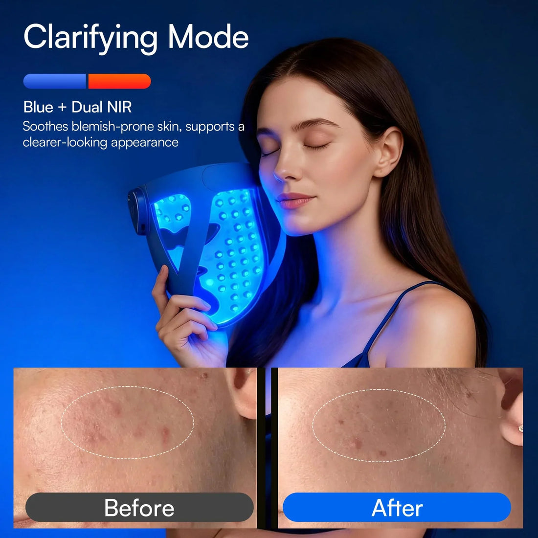 LumaCore Pro 4-in-1 Silicone LED Light Therapy Face Mask – Multi-Wavelength Photon Skin Care Device