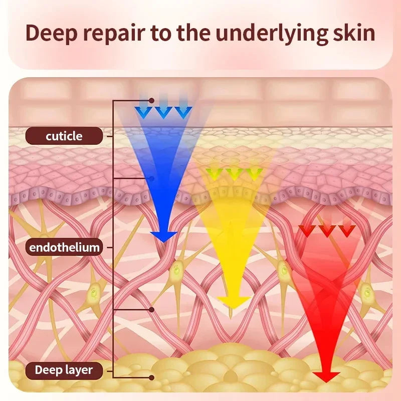 Illustration showing blue, yellow, and red light therapy penetrating skin layers for deep skin repair.