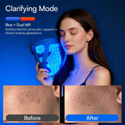 LumaCore Pro 4-in-1 Silicone LED Light Therapy Face Mask – Multi-Wavelength Photon Skin Care Device