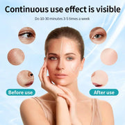 Woman using a black LED face and neck mask in a skincare routine
