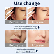 Close-up skincare comparison image for LED face mask routine planning